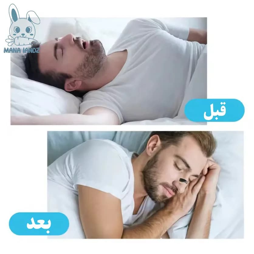 کیت گشاد کننده تنفسی بینی ورزش و خواب ( باز کننده بینی مگنتی) — تصویر ۵
