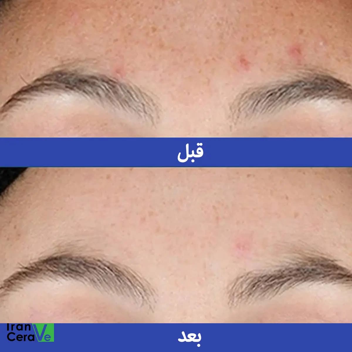 سرم رتینول سراوی CeraVe اصل ۳۰ میلی‌لیتر — تصویر ۴