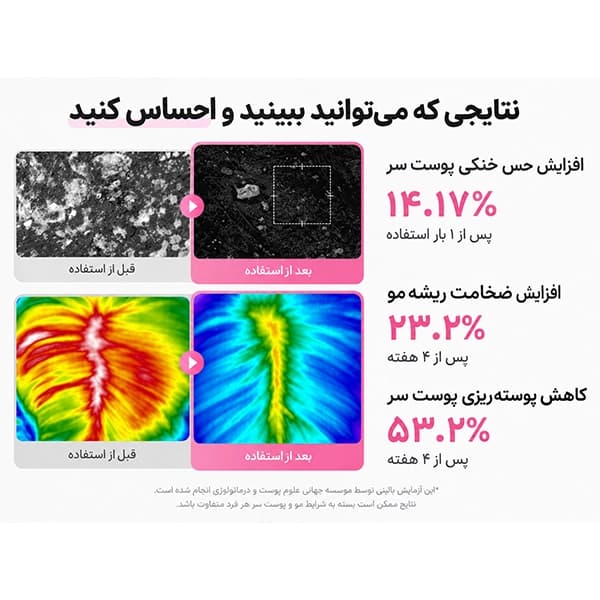 سرم رزماری PDRN مدیکیوب | فعال‌کننده و تقویت‌کننده پوست سر Medicube — تصویر ۴