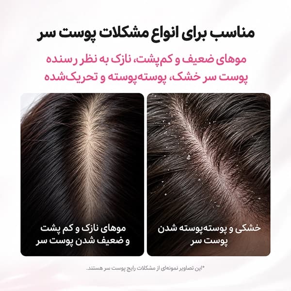 سرم رزماری PDRN مدیکیوب | فعال‌کننده و تقویت‌کننده پوست سر Medicube — تصویر ۳
