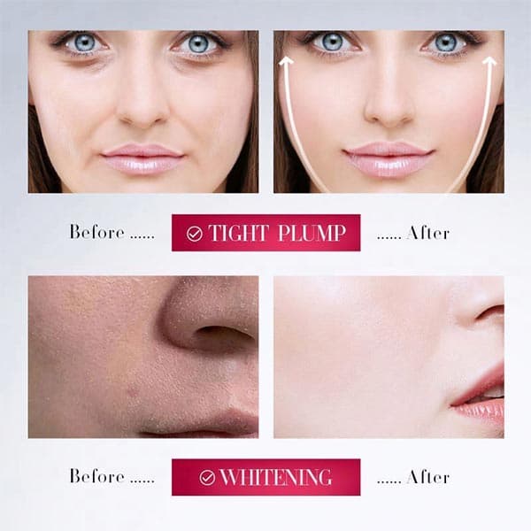 کرم لیفت کننده غبغب و فک سادور مدل V-FACE حجم 30 میلی لیتر (Sadoer Lifts Face Contours And Whitening Moisture V-face Firming Cream) — تصویر ۳