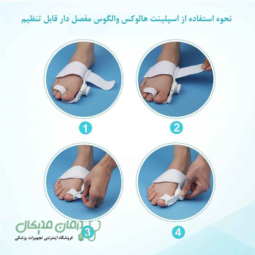 اسپلینت هالوکس والگوس مفصل دار قابل تنظیم اسپنکو ژل — تصویر ۲