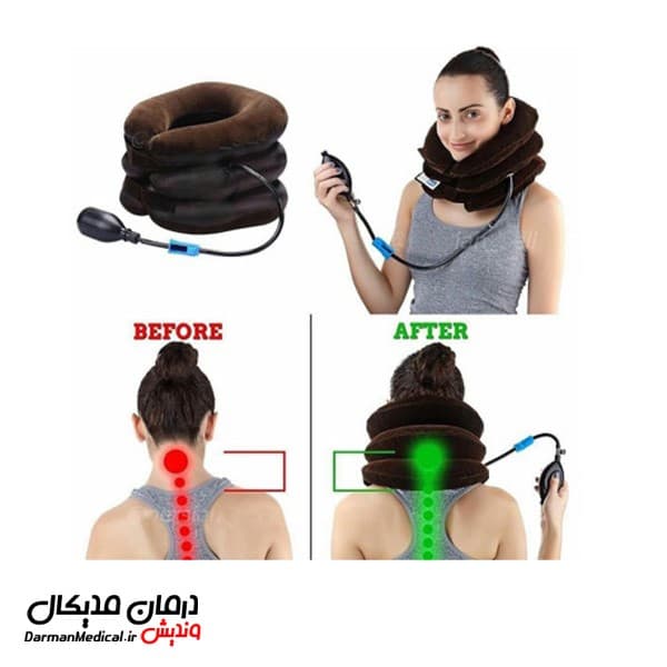 تراکشن گردن Dr.Should (دور گردنی بادی) — تصویر ۲