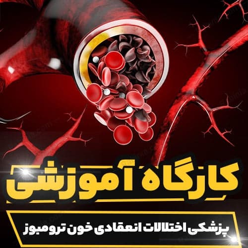 کارگاه آموزشی پزشکی اختلالات انعقادی خون ترومبوز