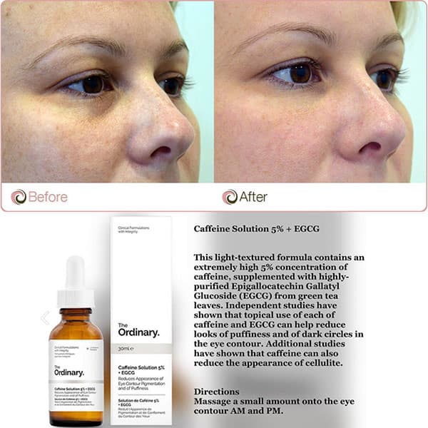 سرم کافئین اوردینری The Ordinary Caffeine Solution 5% + EGCG | حجم ۳۰ میلی‌لیتر — تصویر ۳