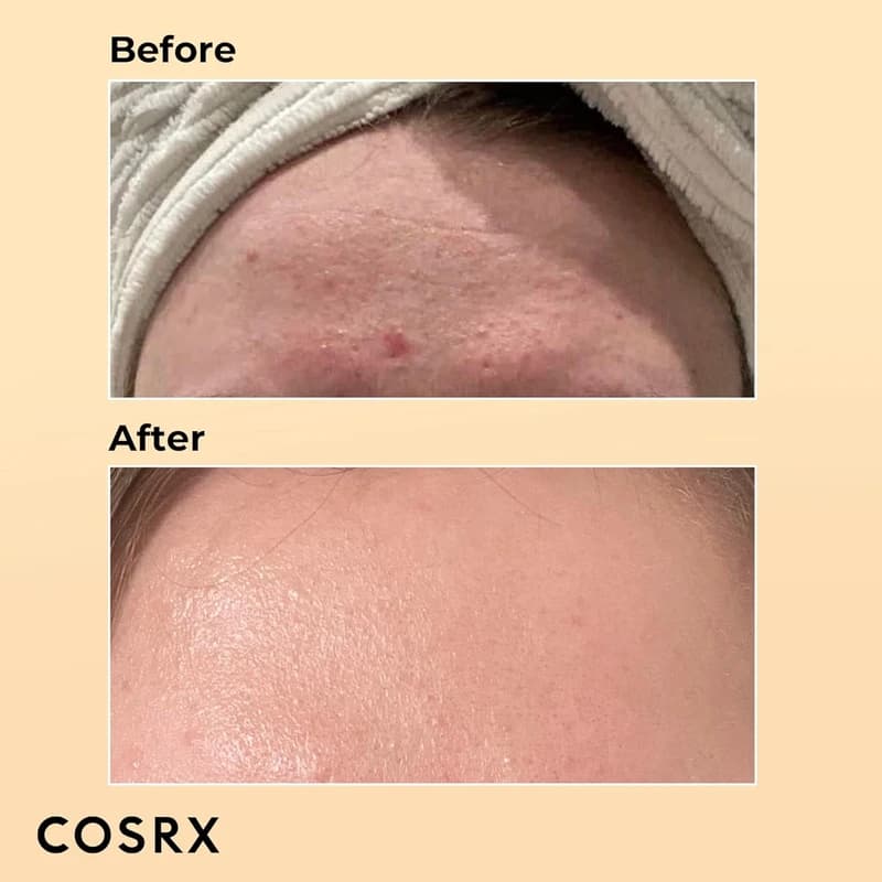 سرم حلزون کوزارکس COSRX Advanced Snail 96 Mucin Power Essence | حجم 100 میلیلیتر — تصویر ۴