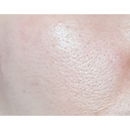 آمپول کوچک‌کننده منافذ و آبرسان سنتلا اسکین 1004 SKIN1004 Madagascar Centella Poremizing Fresh Ampoule | حجم ۱۰۰ میلی‌لیتر — تصویر ۲