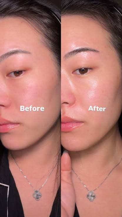 سرم ضد لک ترانگزامیک اسید ۶٪ و نیاسینامید ۱۰٪ پوریتو PURITO SEOUL TXA 6 Niacinamide 10 Retinal Serum | حجم ۳۰ میلی‌لیتر — تصویر ۲