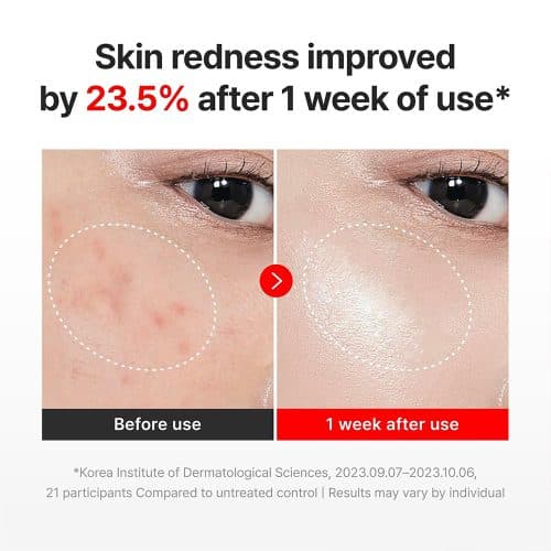کرم ترمیم‌کننده و ضدچروک سنتلیان 24 Centellian24 Madeca Cream Time Reverse | حجم 50 میلی‌لیتر — تصویر ۲