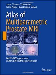 دانلود کتاب Atlas of Multiparametric Prostate MRI