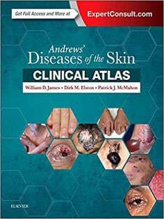 دانلود کتاب Andrews’ Diseases of the Skin Clinical Atlas