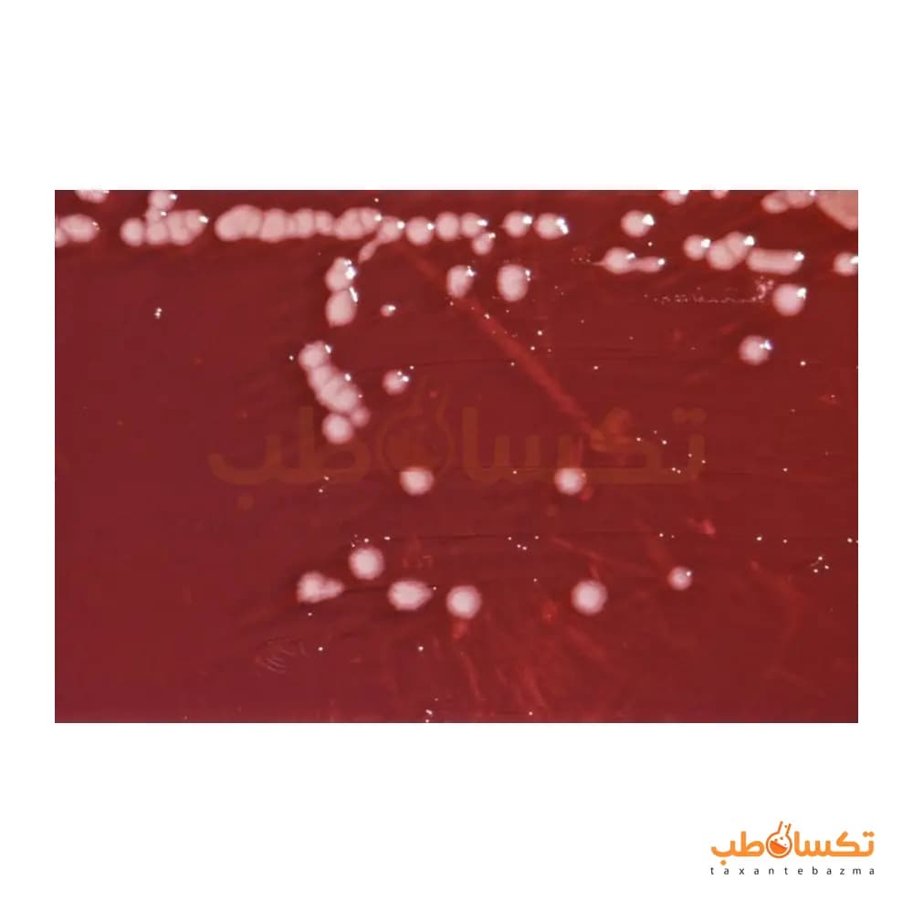 سوش استاندارد سودوموناس آئروژینوزا ATCC 27853 پادتن طب