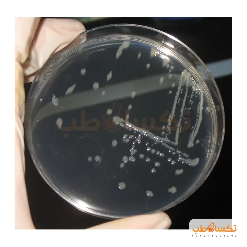 سوش استاندارد اشریشیا کلی ATCC 25922 پادتن طب