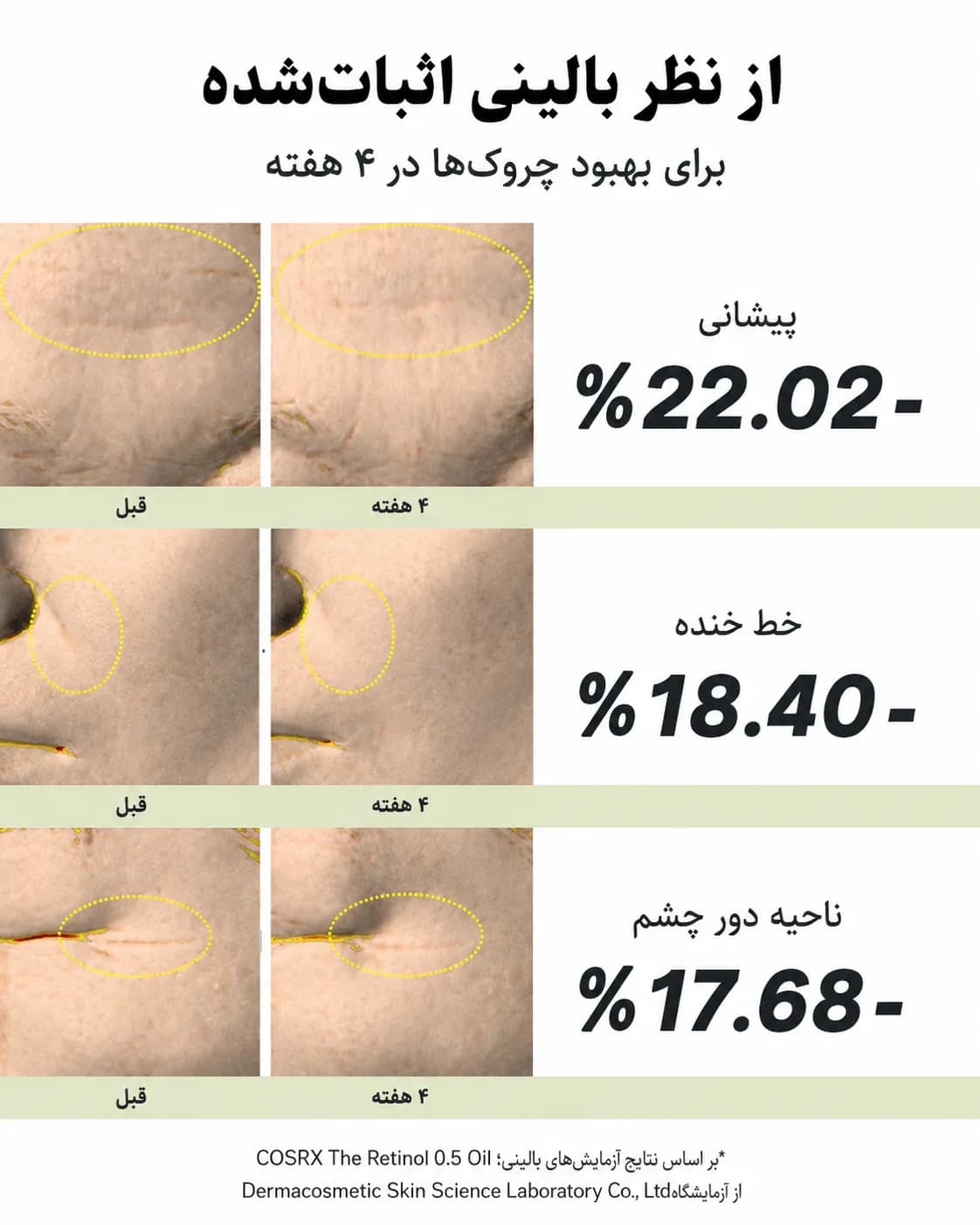 سرم روغنی رتینول 0.5 کوزارکس COSRX The Retinol 0.5 Oil حجم 20 میل - یاز شاپ — تصویر ۶