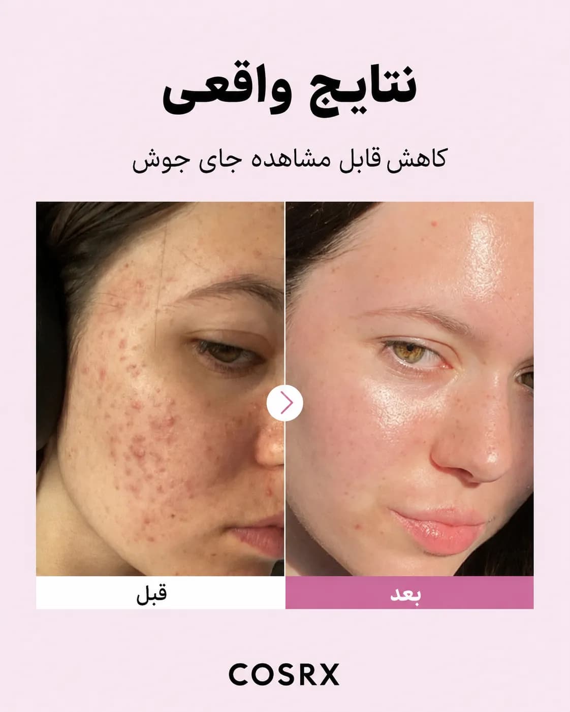 سرم نیاسینامید 15 درصد ضد منافذ و کنترل چربی کوزارکس COSRX The Niacinamide 15 Serum حجم 20 میل - یاز شاپ — تصویر ۵