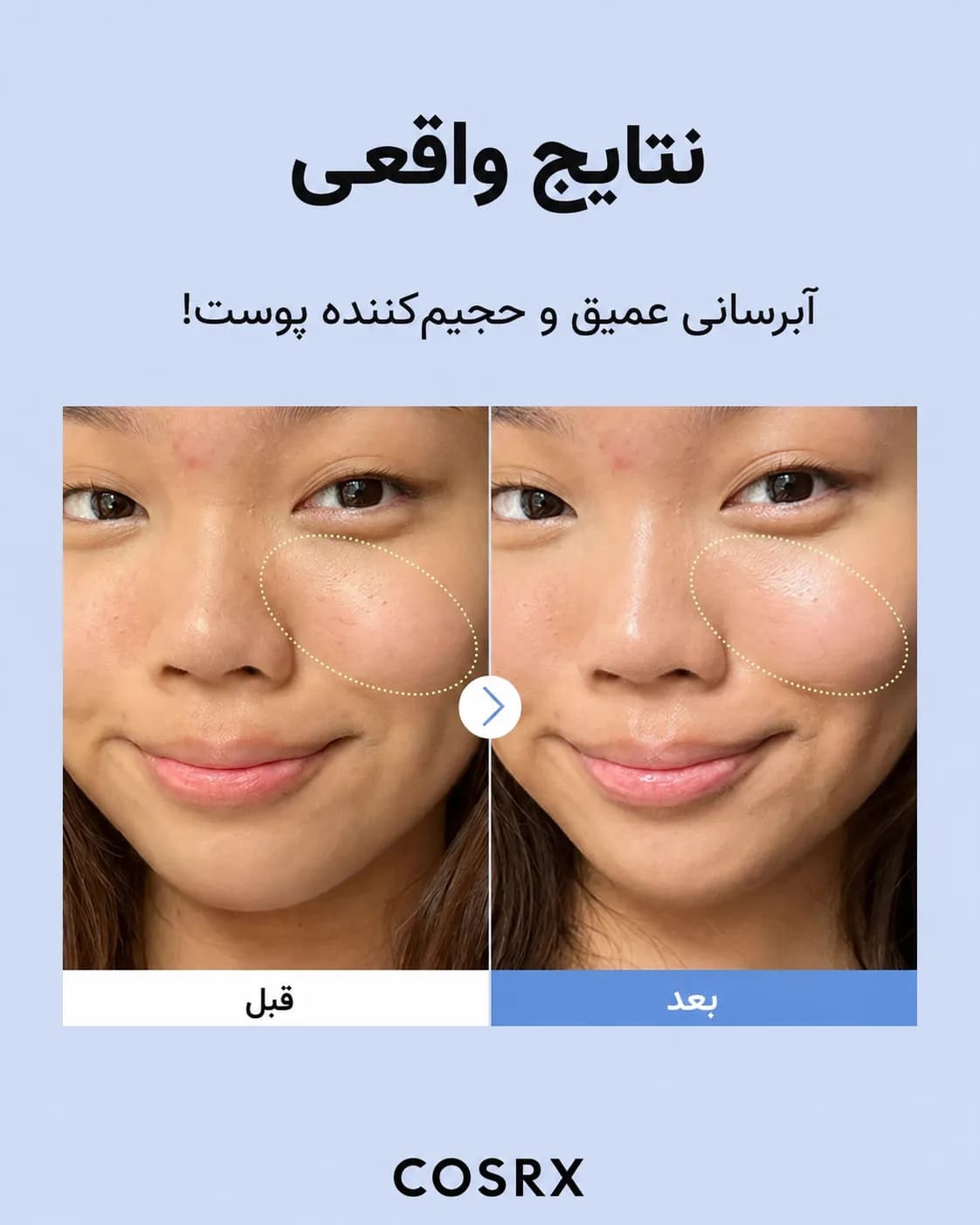 سرم آبرسان هیالورونیک اسید 3 کوزارکس COSRX The Hyaluronic Acid 3 Serum حجم 20 میل - یاز شاپ — تصویر ۷