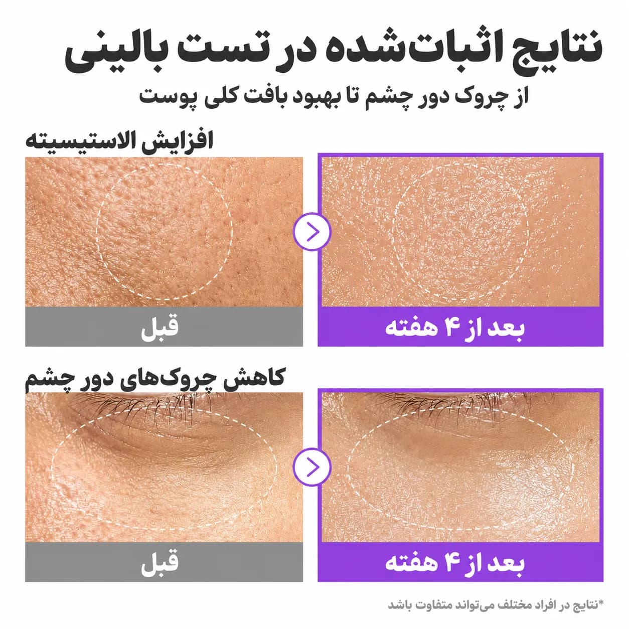 اسنس سفتکننده و پلامپکننده NAD+ نامبوزین شماره ۹ حجم ۵۰ میل | Numbuzin No.9 NAD+ BIO Lifting-sil Essence - یاز شاپ — تصویر ۸