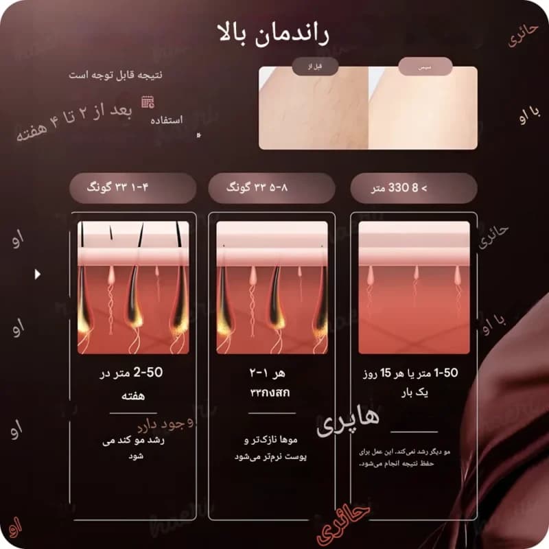 دستگاه لیزر خانگی حذف موهای زائد ۱ میلیون شات مدل BHRL-13 با فناوری IPL و Ice Cooling — تصویر ۵