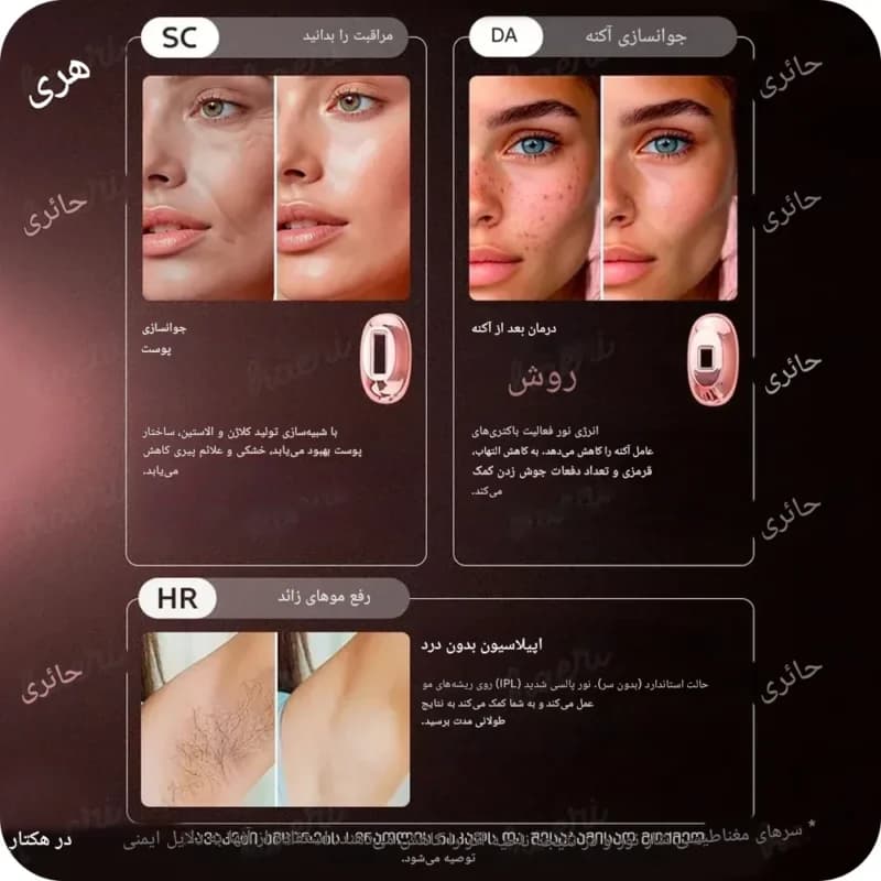دستگاه لیزر خانگی حذف موهای زائد ۱ میلیون شات مدل BHRL-13 با فناوری IPL و Ice Cooling — تصویر ۴
