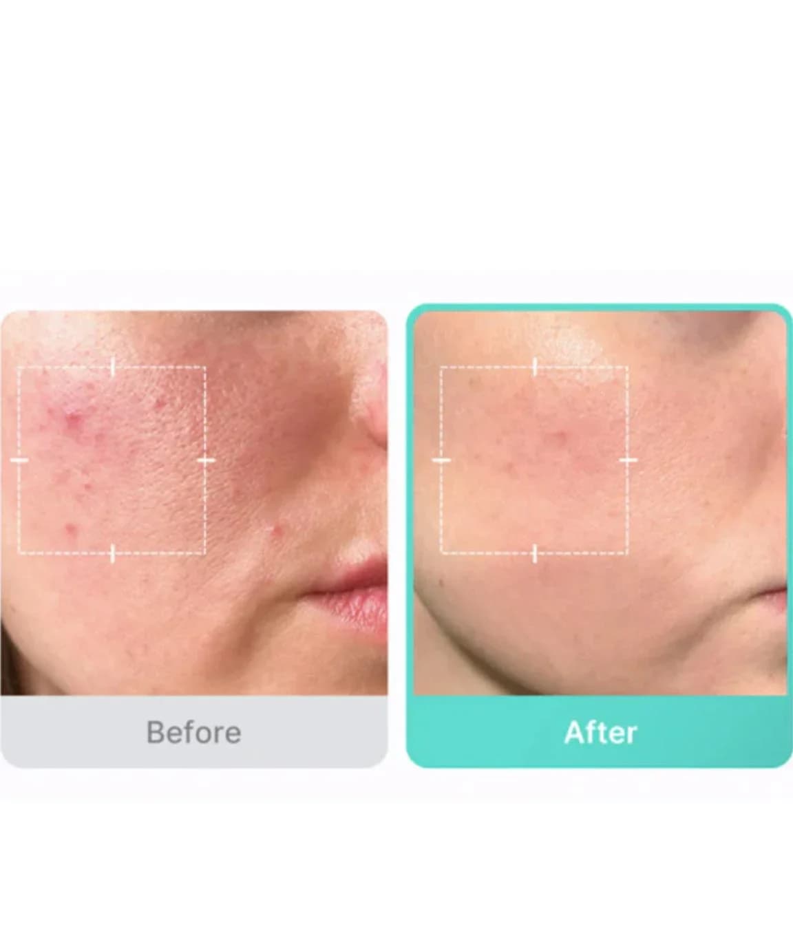 سرم آزلائیک اسید ۱۶٪ مدیکیوب (Medicube) — تصویر ۴
