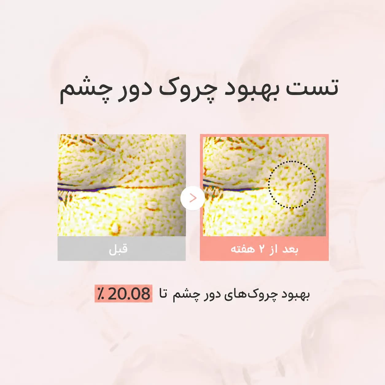 سرم دور چشم جینسینگ و رتینال بیوتی آف جوسان حجم ۳۰ میل | Beauty of Joseon Revive Eye Serum Ginseng + Retinal — تصویر ۷