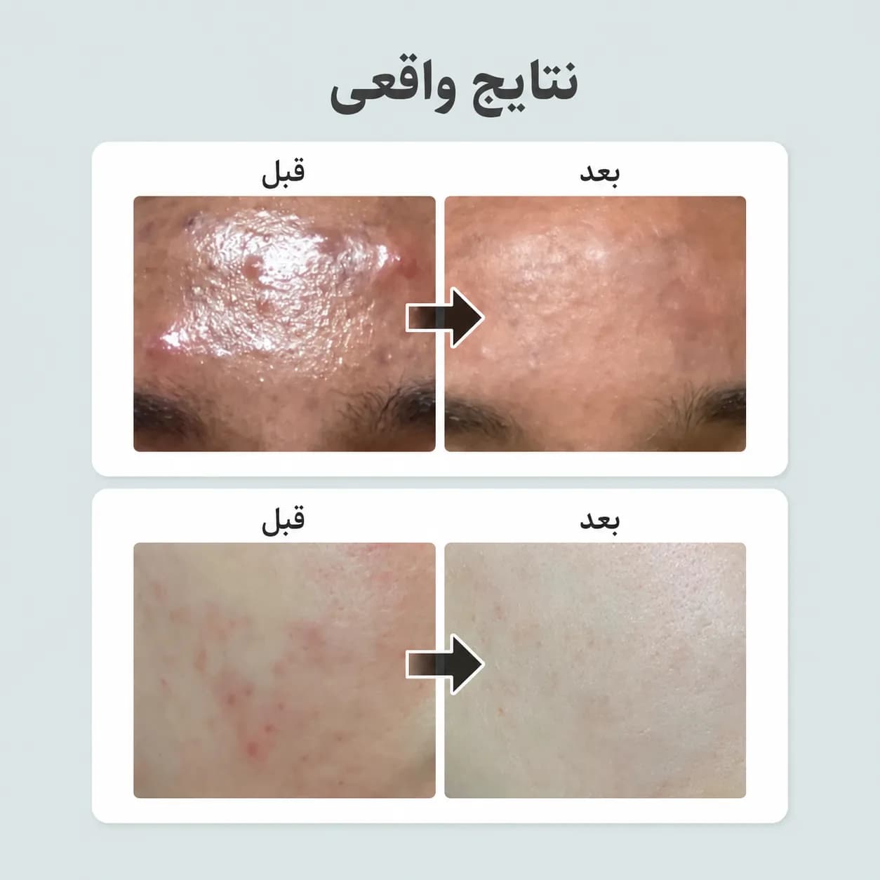 تونر تسکیندهنده و کنترل چربی گیاهی نامبوزین شماره ۱ حجم ۳۰۰ میل | Numbuzin No.1 Pure-Full Calming Herb Toner — تصویر ۷