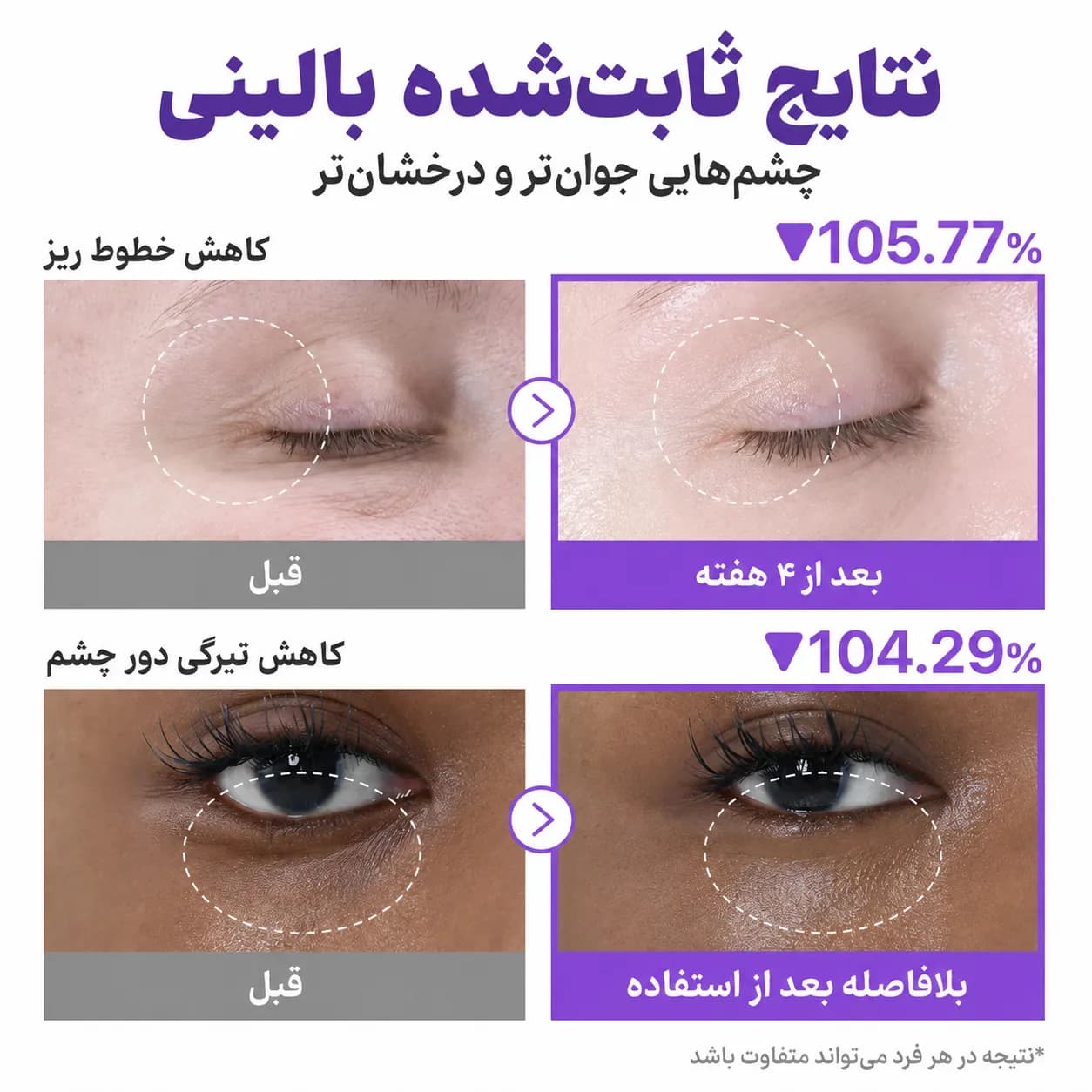 ست مراقبت دور چشم NAD+ و رتینول نامبوزین شماره ۹ شامل کرم ۱۰ میل و پچ کلاژن | Numbuzin No.9 Daily Eye Care Duo — تصویر ۷