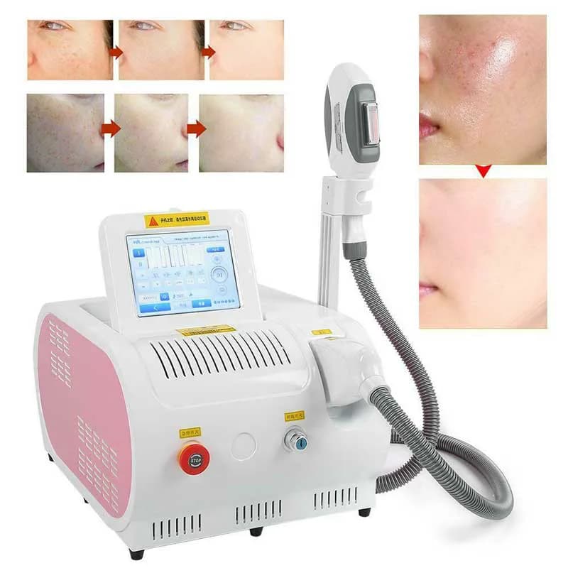 دستگاه لیزر ریمور موهای زائد اس اچ ار ایلایت SHR — تصویر ۵
