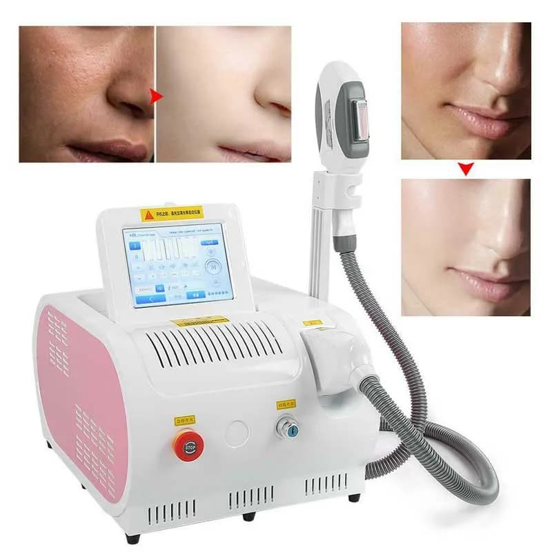 دستگاه لیزر ریمور موهای زائد اس اچ ار ایلایت SHR — تصویر ۳