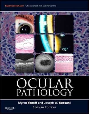 دانلود کتاب Ocular Pathology