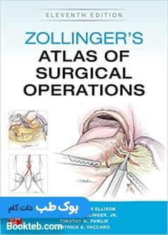 Zollinger’s Atlas of Surgical Operations