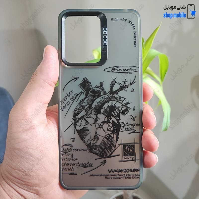 قاب گوشی شیائومی ردمی نوت 12 4G (کاور فانتزی So Cool طرح آناتومی قلب)