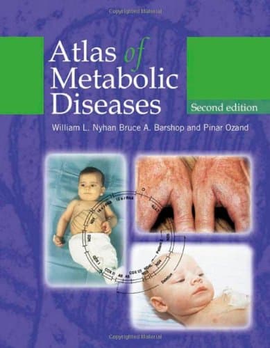 کتاب Atlas of Metabolic Diseases, 2nd Edition نسخه کامل