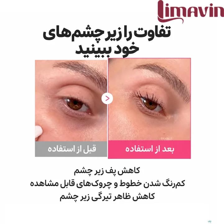 پچ هیدروژلی زیر چشم کلاژن و PDRN مدی کیوب آبرسان و ضد پف و تیرگی و ضد چروک 28 عددی — تصویر ۳
