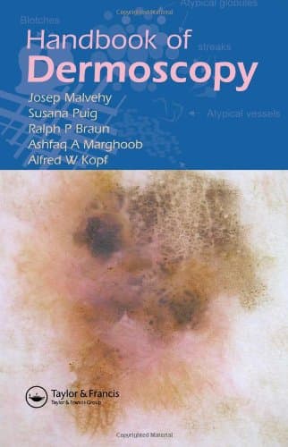 کتاب Handbook of Dermoscopy نسخه کامل
