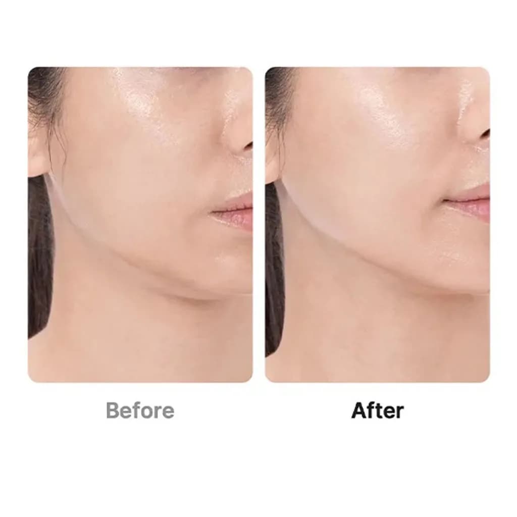 دستگاه جوانساز بوستر پرو مدی کیوب AGE-R Booster Pro(کدتخفیف اعمال شده) — تصویر ۳