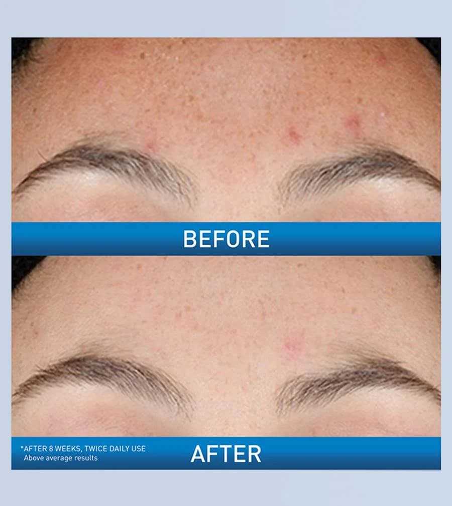 سرم ضد لک و ضد جوش سراوی مدل Resurfacing Retinol — تصویر ۳