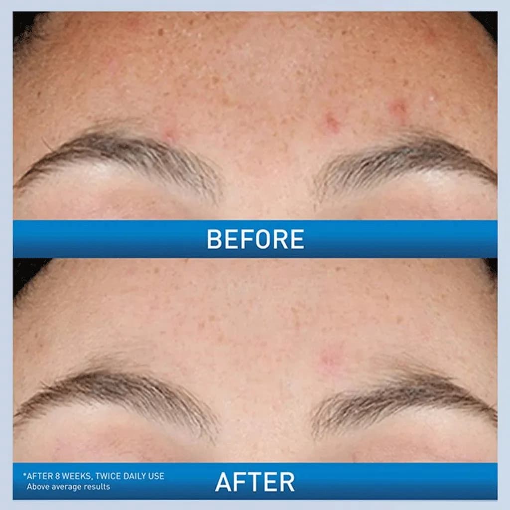 سرم ضد لک و ضد جوش سراوی مدل Resurfacing Retinol — تصویر ۹