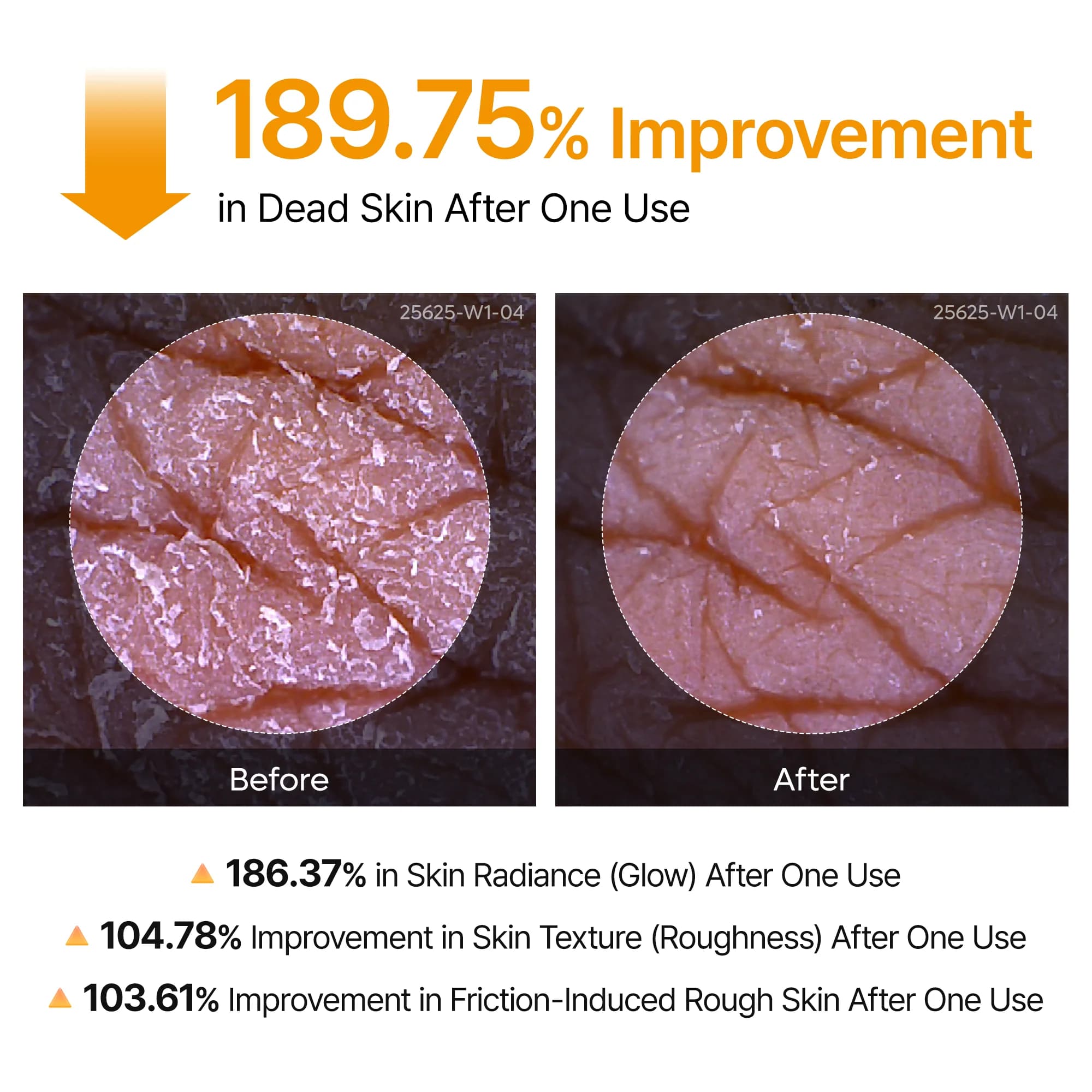 اسپری لایه‌ بردار و روشن‌ کننده بدن دکتر ملاکسین مدل Kojic Acid Turmeric — تصویر ۵