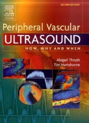 دانلود کتاب Peripheral Vascular Ultrasound