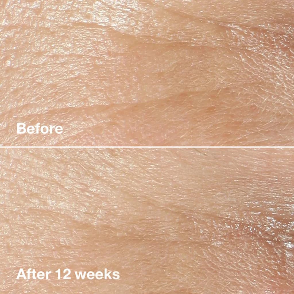 کرم دور چشم کلینیک ضد چروک ترمیم و آبرسانی و تغذیه کننده 15میل Clinique Smart Clinical Repair — تصویر ۵