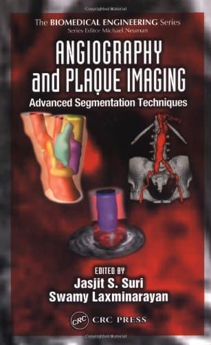 دانلود کتاب Angiography and Plaque Imaging