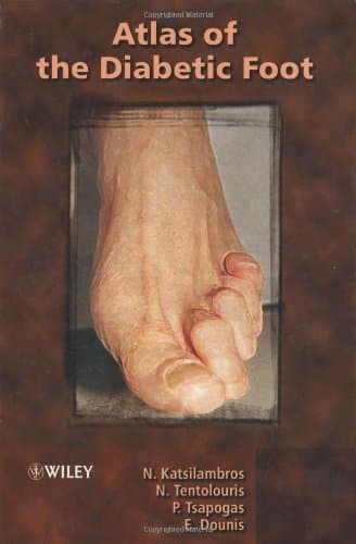 دانلود کتاب Atlas of the Diabetic Foot