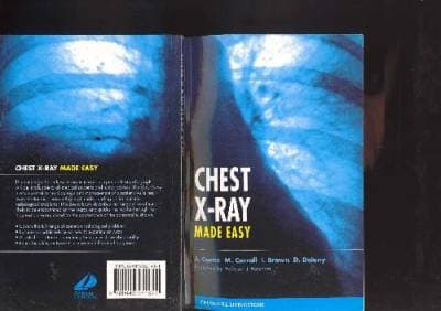 دانلود کتاب Chest X-Ray Made Easy