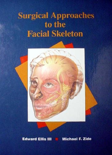 دانلود کتاب Surgical Approaches to the Facial Skeleton