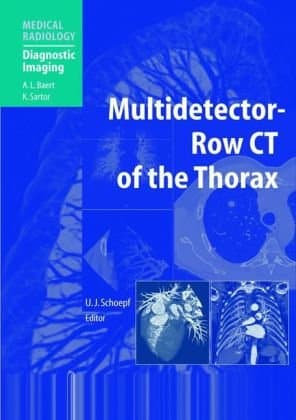 دانلود کتاب Multidetector-Row CT of the Thorax