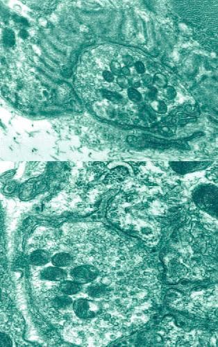 دانلود کتاب Myasthenia Gravis and Related Disorders