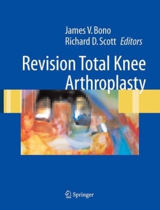 دانلود کتاب Revision Total Knee Arthroplasty
