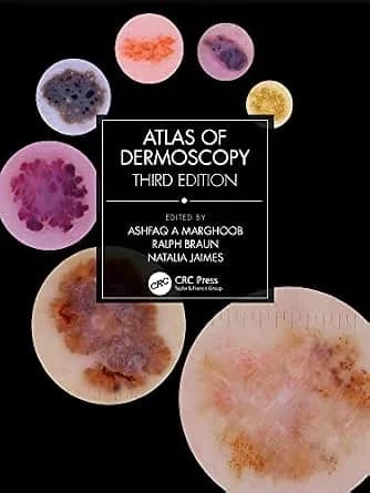 و دانلود نسخه کامل کتاب زبان اصلی Atlas of Dermoscopy: Third Edition PDF | دانلود کتاب خارجی