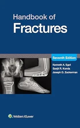 و دانلود نسخه کامل کتاب زبان اصلی Handbook of Fractures: eBook without Multimedia PDF | دانلود کتاب خارجی
